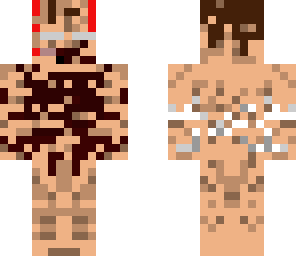 the ***ist skin in the world