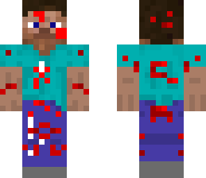 injured steve