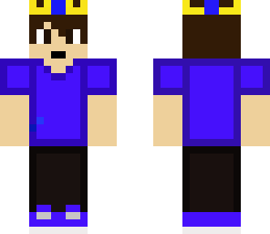 shs's skin