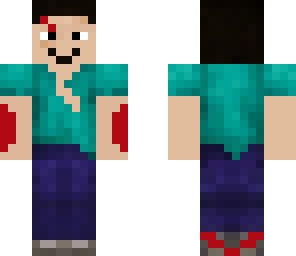 shark attack survivor