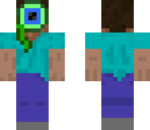 septic eye