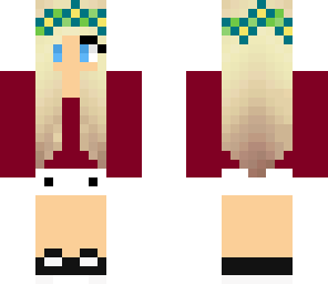 anna's skin