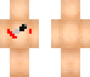 stap skin