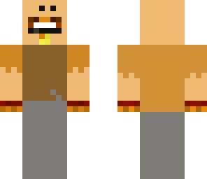 smiling notch