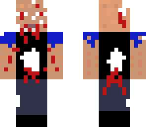 infected skin