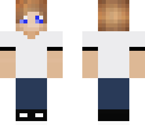 fixed