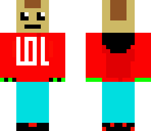 matt'sskin