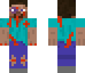 steve got beat up
