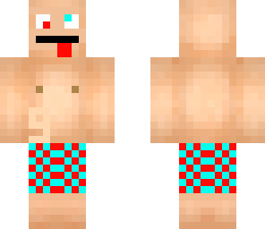 myskin