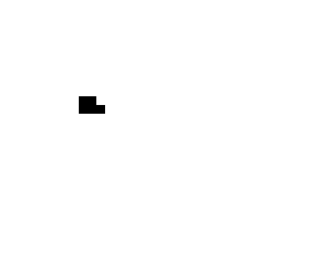tooth with cavity