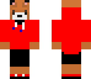 dylan's skin