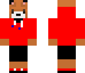 dylan's skin