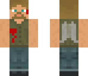 daryl dixon injured slightly