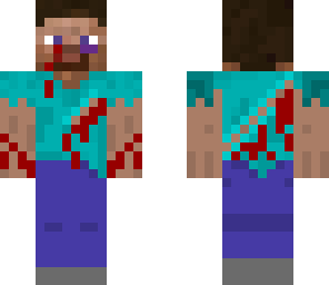beaten up steve