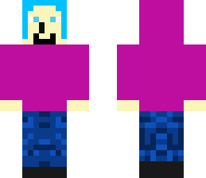 frezzles' skin