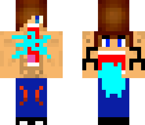 annoying back twin