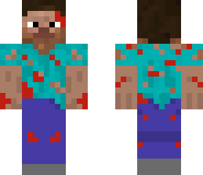 injured steve
