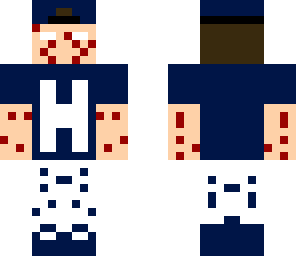 herolim