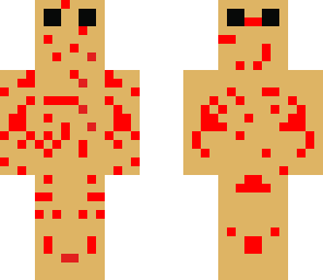 chickenpoxperson