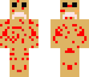 sadpersonwithchickenpox