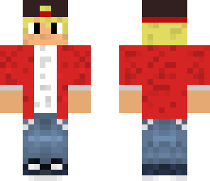 skin for albino's