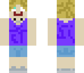 stephanie's skin