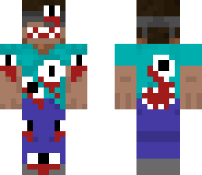 eyezor infectet 