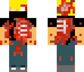 exoskeleton