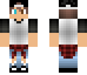 boy with two different eye colors