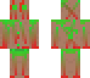 toxoplamos