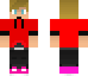 dylan's skin