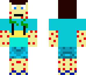 summer chickne pox