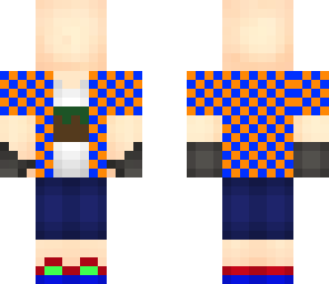 vincent's skin
