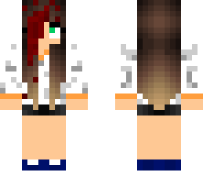bite of '87 victim