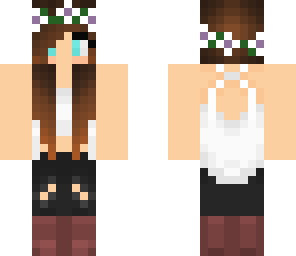 shay's skin