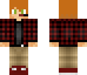 my skin