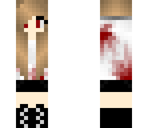 girl with no arms