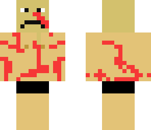 shark attack survivor