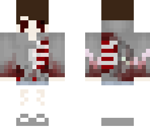dead boy