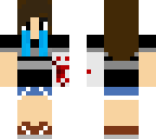 arm hurt