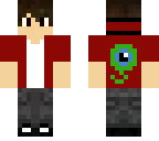 septic eye boy