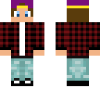 skin4