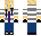 omg its my skin lol