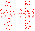 chicken pox