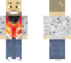 patcho