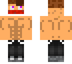 a skin