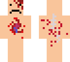 dying man