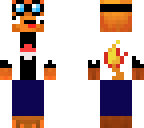 matthew's skin