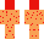chicken pox