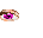 pink eye